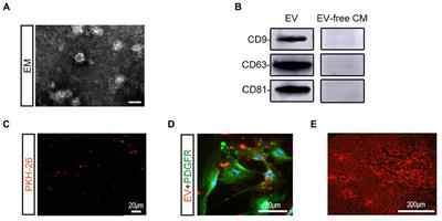 Bone Mesenchymal Stem Cell-Derived Extracellular Vesicles Promote Recovery Following Spinal Cord Injury via Improvement of the Integrity of the Blood-Spinal Cord Barrier